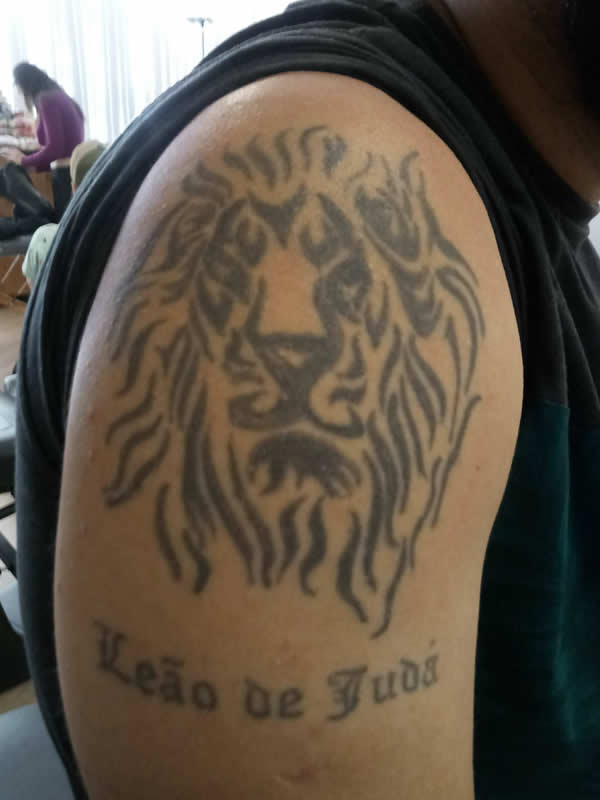 Remoção de tatuagem a laser em Curitiba